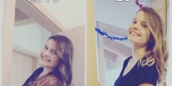 Angela vorher nachher Vorher nachher Bild von Angela (2015 und 2017)