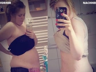 Vorher Nachher Bild von GYMONDO Mitglied Jennifer