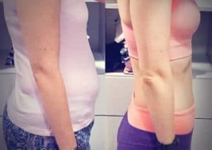 Vorher Nachher Bild seitlich