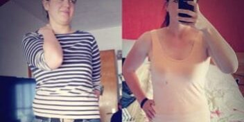 Vorher Nachher Bild von GYMONDO Mitglied Tanya