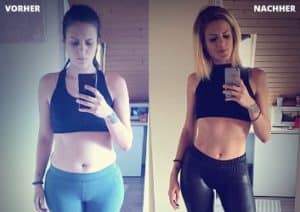 Vorher Nachher Bild Rosa