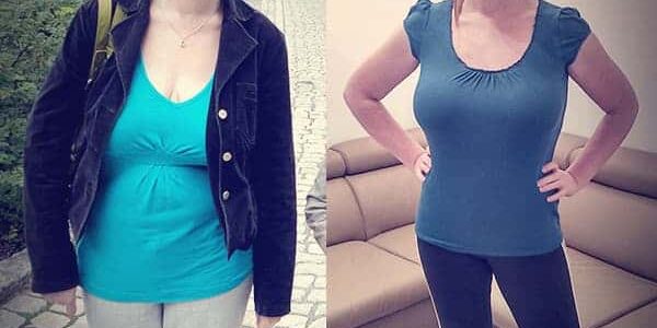 Vorher Nachher Bild Susann