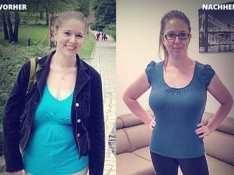 Susann vorher nachher bild