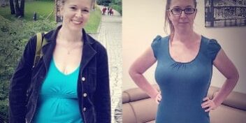 Susann vorher nachher bild