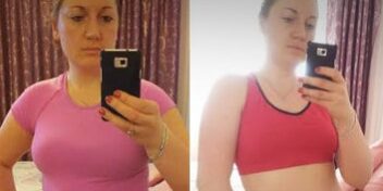 inna-vorher-nachher-bild