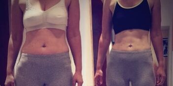 sonja vorher nachher Vorher Nachher Bild von GYMONDO Mitglied Sonja