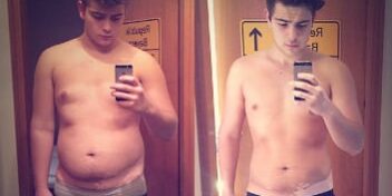 Vorher Nachher Bild Nicolas